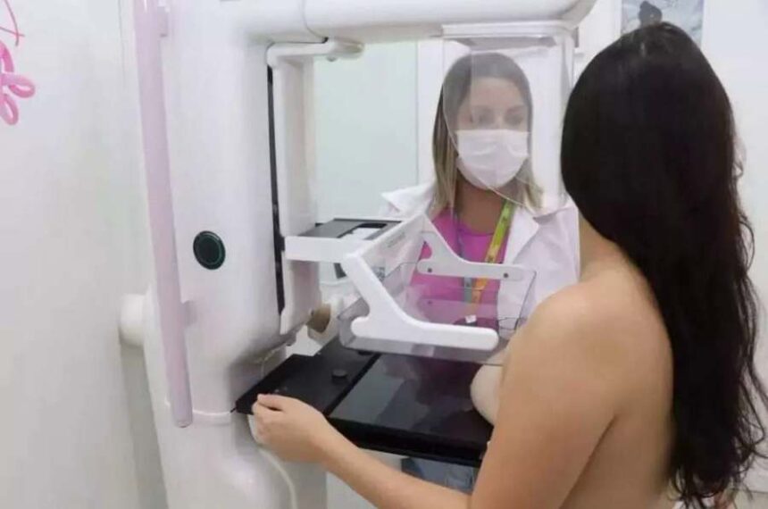 mamografias 