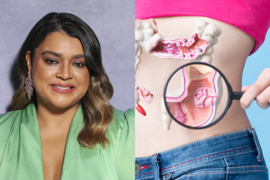 Câncer Colorretal: Saiba mais sobre o câncer que Preta... ABC do ABC