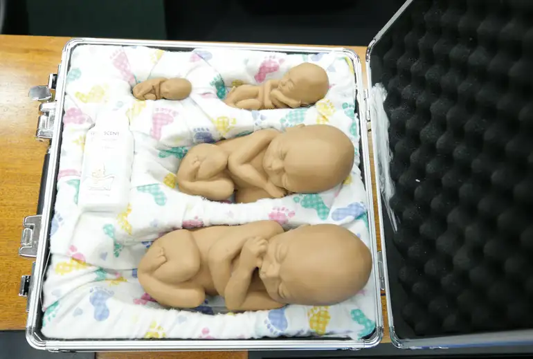 Proibição do aborto após 22 semanas avança no Senado