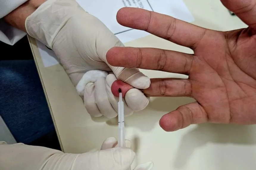 Mauá capacita rede para diagnóstico precoce de HIV, sífilis e hepatites. ISTs 