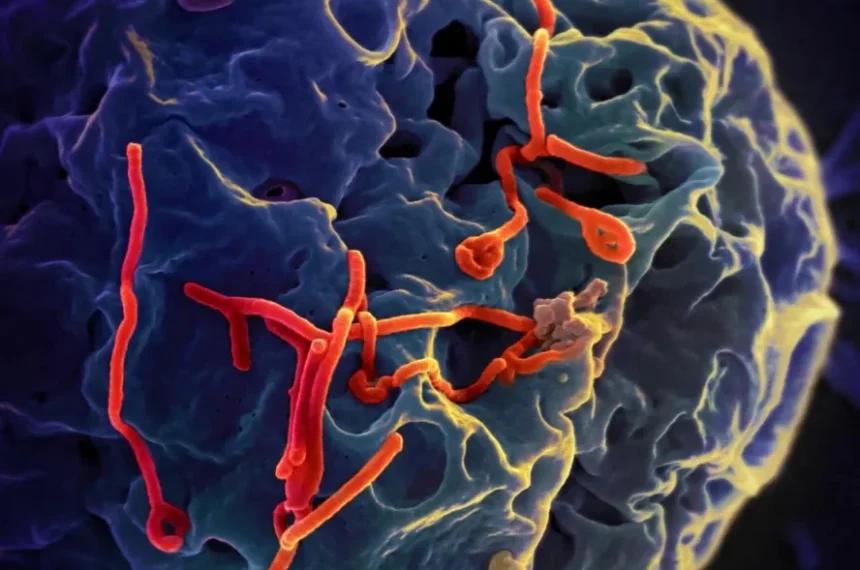 Ebola. 